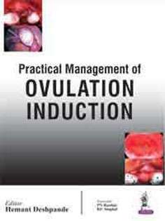 Practical Management of Ovulation Induction