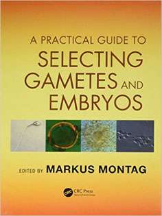 A Practical Guide to Selecting Gametes and Embryos