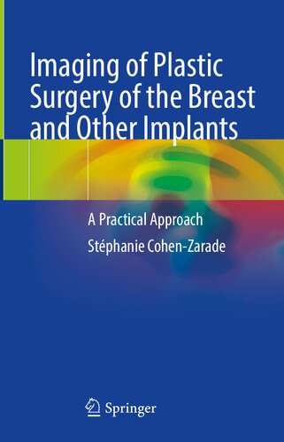 Imaging of Plastic Surgery of the Breast and Other Implants: A Practical Approach