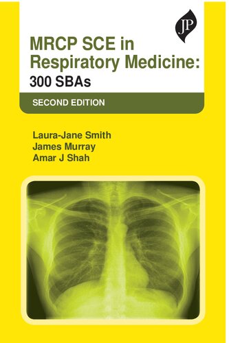 MRCP SCE in Respiratory Medicine: 300 SBAs