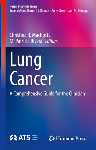 Lung Cancer: A Comprehensive Guide for the Clinician (Respiratory Medicine)