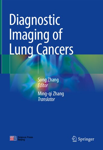 Diagnostic Imaging of Lung Cancers