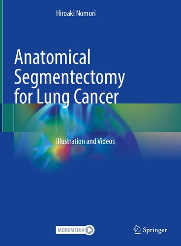 Anatomical Segmentectomy for Lung Cancer: Illustration and Videos