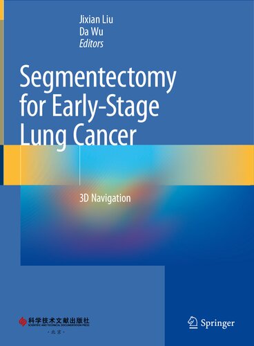 Segmentectomy for Early-Stage Lung Cancer: 3D Navigation