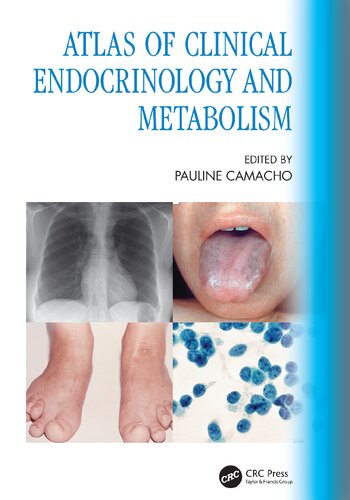 Atlas of Clinical Endocrinology and Metabolism