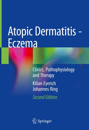 Atopic Dermatitis - Eczema: Clinics, Pathophysiology and Therapy